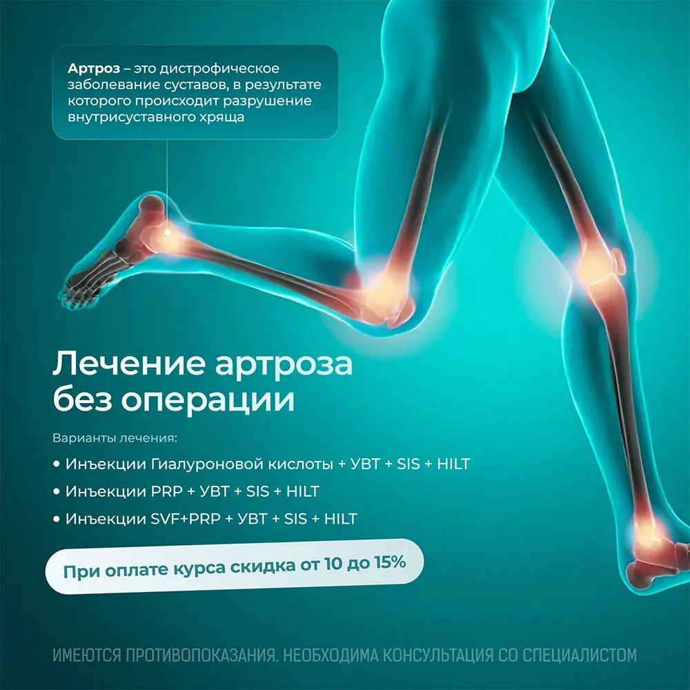 Лечение артроза без операции