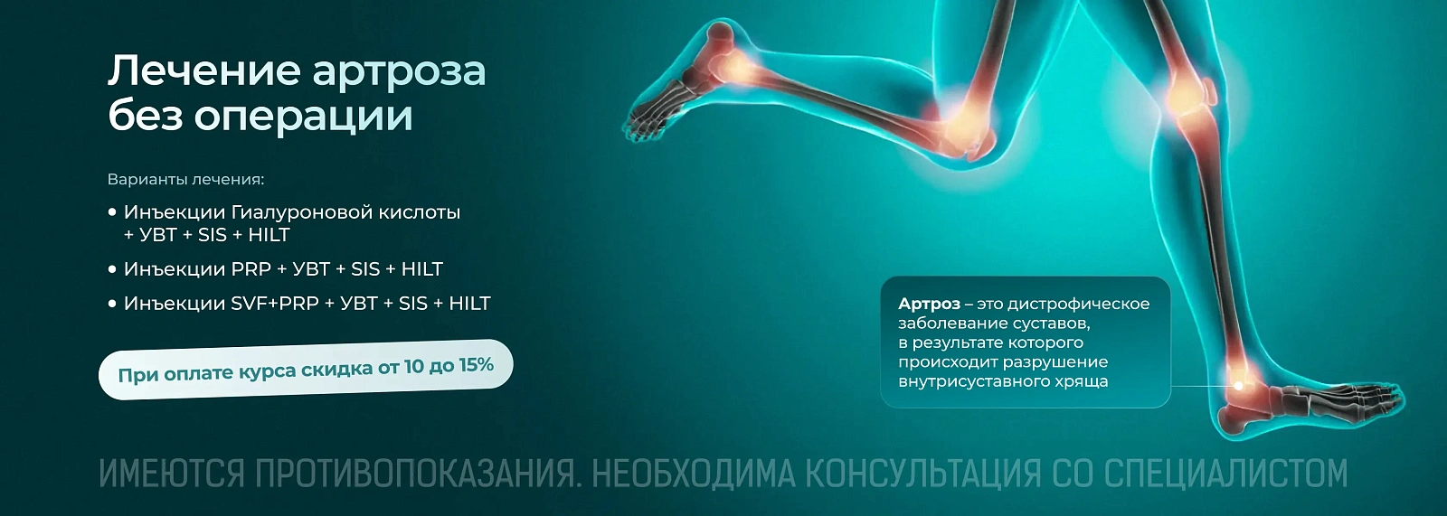 Лечение артроза